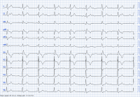 Cas clinique miniature