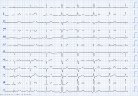 Cas clinique miniature