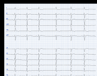 Cas clinique miniature