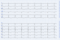 Cas clinique miniature