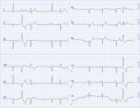Cas clinique miniature