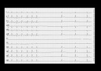 Cas clinique miniature
