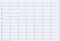 Cas clinique miniature