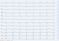 Cas clinique miniature