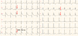 www.e-cardiogram.com