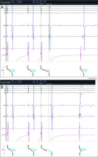 Fichier:Figure 9 - Saut sans écho.jpg