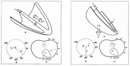 S1Q3 — Uness Cardiologie