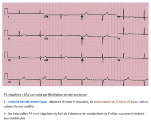 FA et BAV complet .png