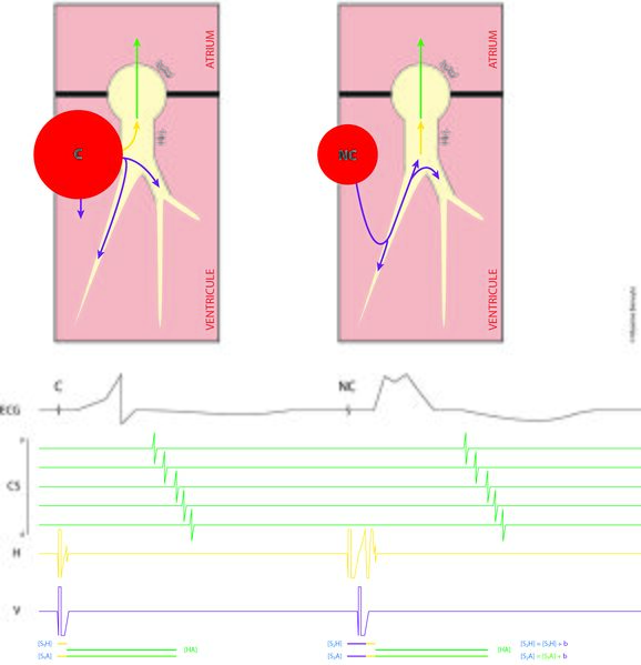 Fichier:FIgure 12 - Negative PHP.jpg
