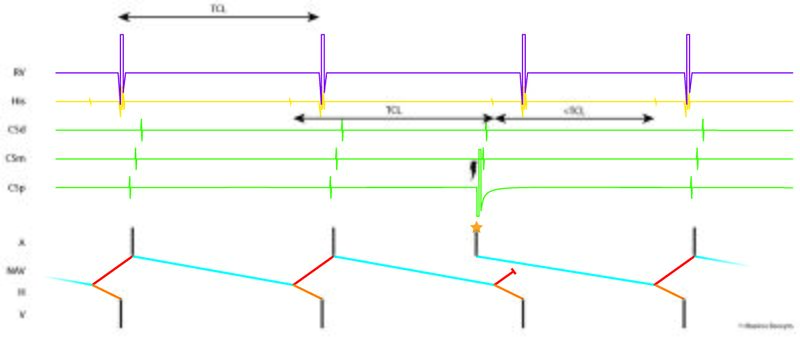 Fichier:Figure 22 - Early PAC.jpg