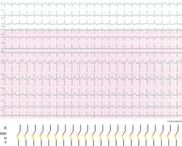 Fichier:Figure 2 - JET 1-1.jpg